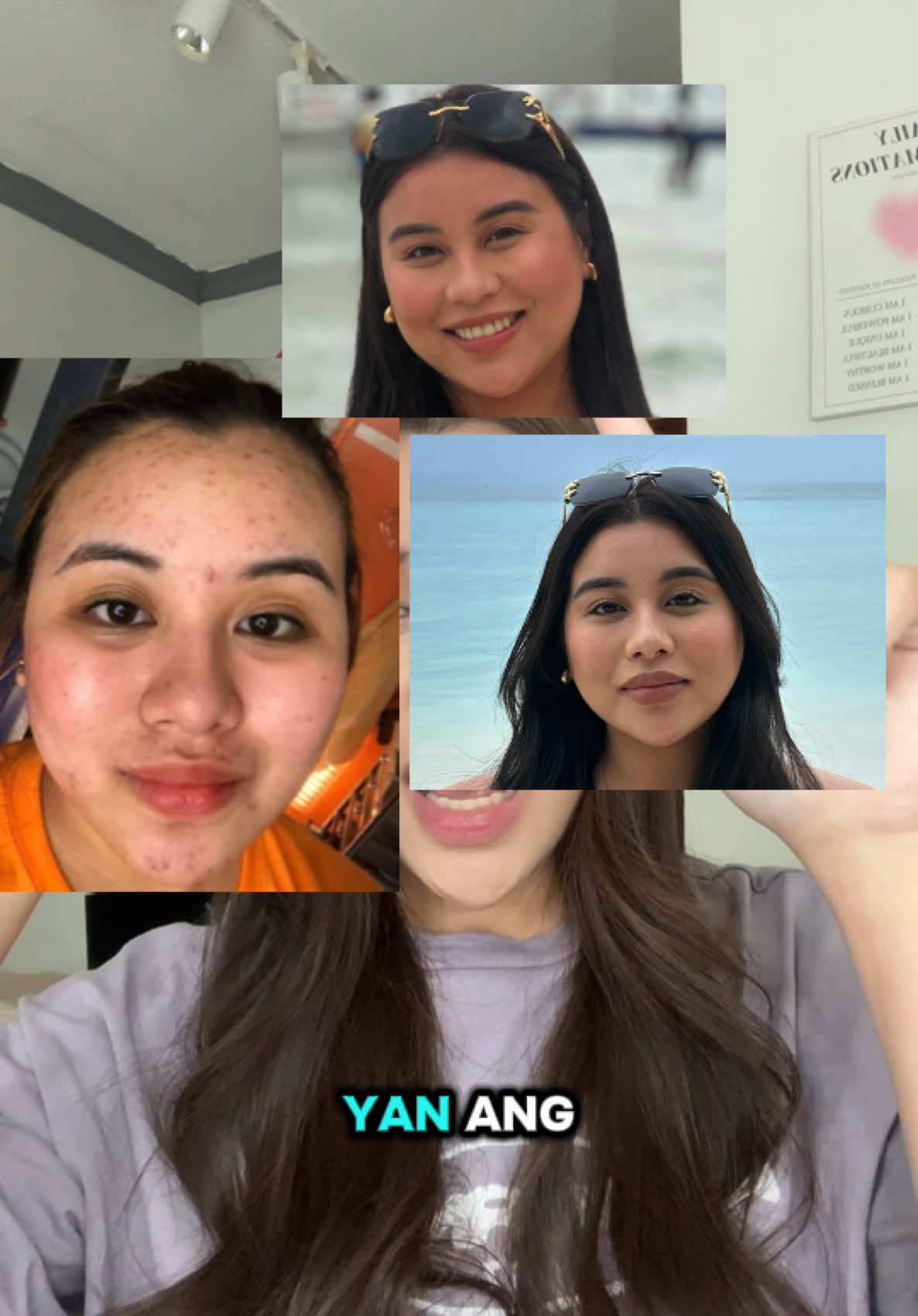 hugis bigas pala talaga ang face ko?! 🤯 #SupplementProgress #PureForm #magnesium #ashwagandhabenefits #ashwagandhasupplements @Pure Form 