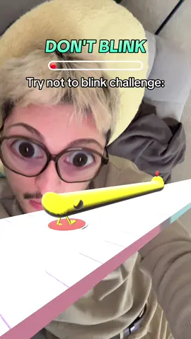 😳😳