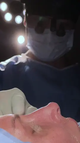 O resultado ficou incrível! Estou em casa me recuperando e logo estarei aqui com vocês!!! Gostaram? Me fala aí nos comentários!  #viraltiktok #cirurgia #rinoplastia #plastica 