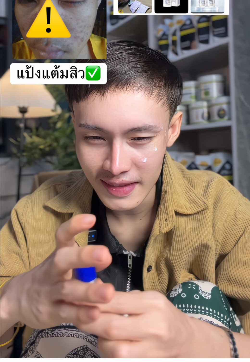 #แป้งแต้มสิว #สิวอุดตัน #สิว #รีวิวบิวตี้ #icelerskin Acne Serum  