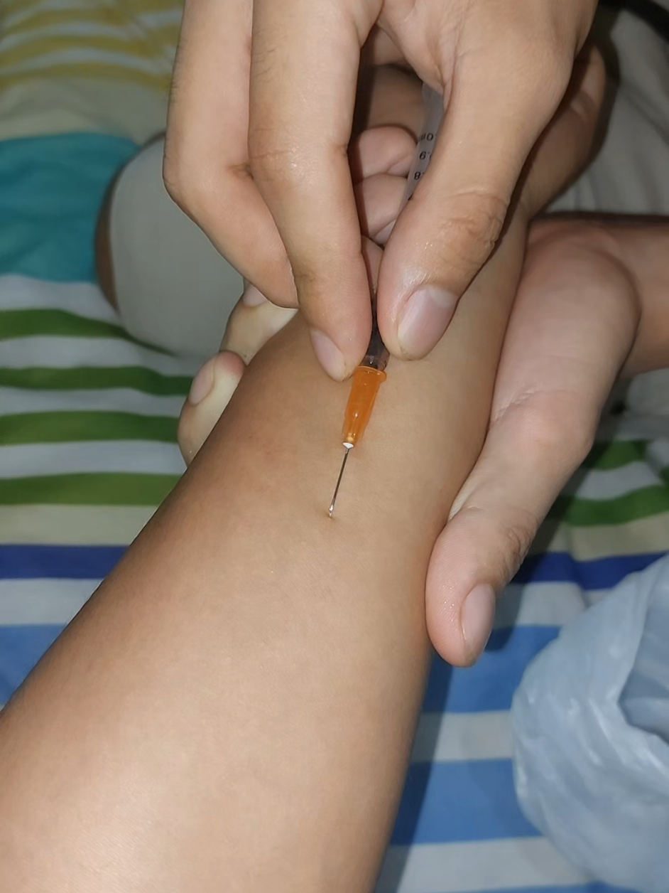Segundo intento de hacer la Pápula intradérmica de @𝑮𝒂𝒕𝒐 🐱🕶️ , la parte final del video fue su venganza :( 