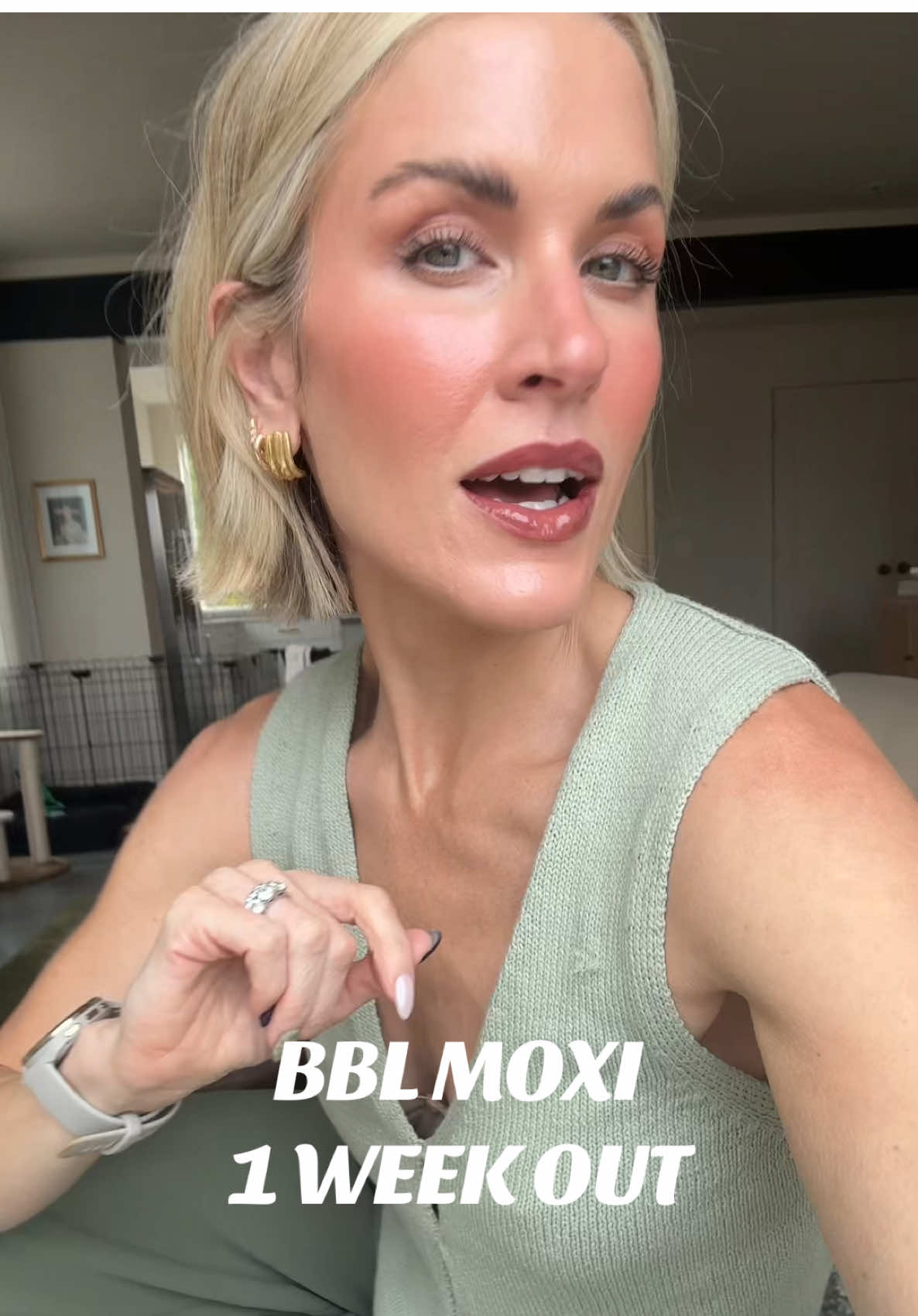 Pretty much recovered 1 week out!! Absolutely obsessed with how much skin is looking🥹 #bbl #moxi #skincare #laser 