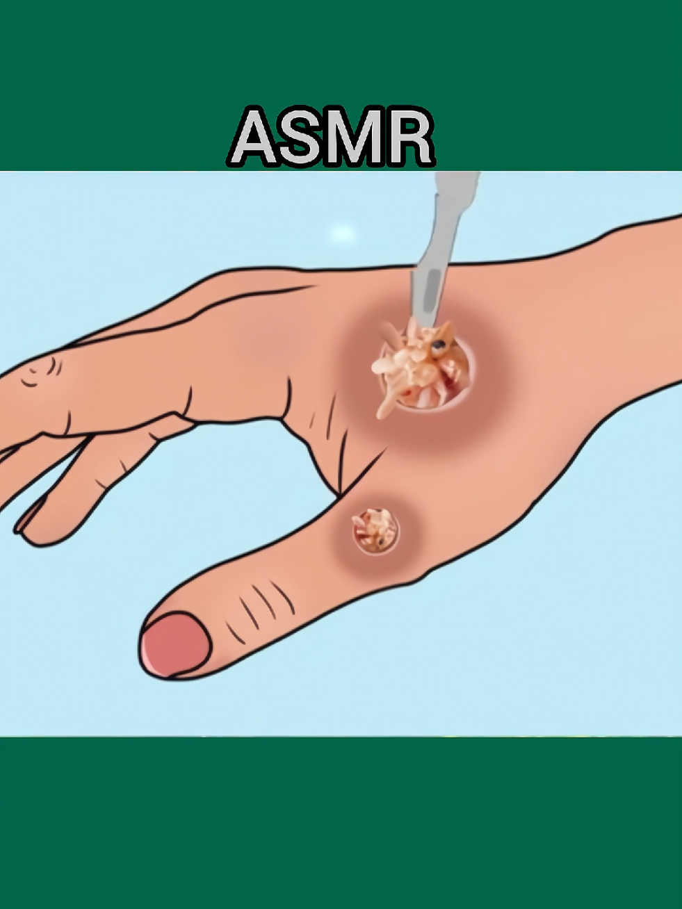 ASMR Treatment #asmr #ukdoctor #SatisfyingVideo #viraltiktok #relaxingvideos 