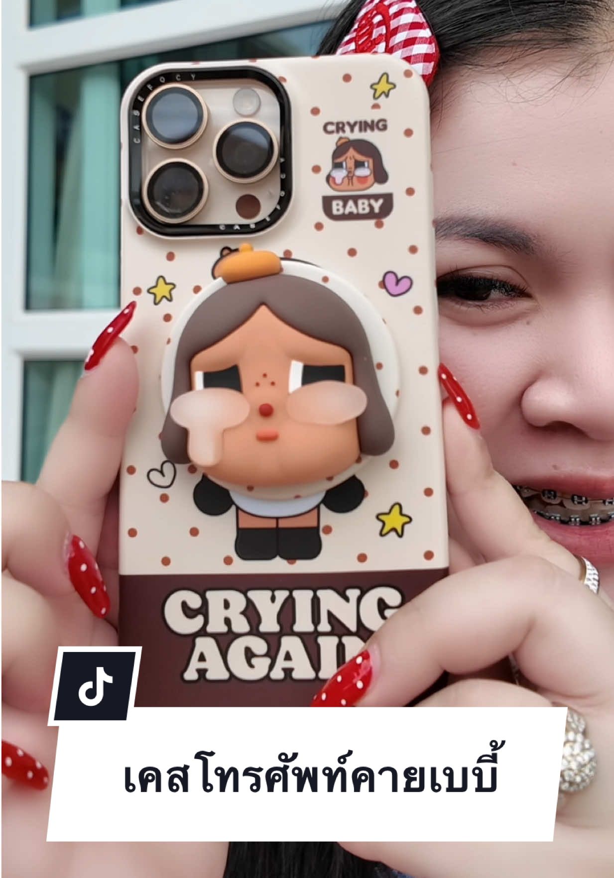 #เคสคายเบบี้  #เคสโทรศัพท์  #เคสไอโฟน 