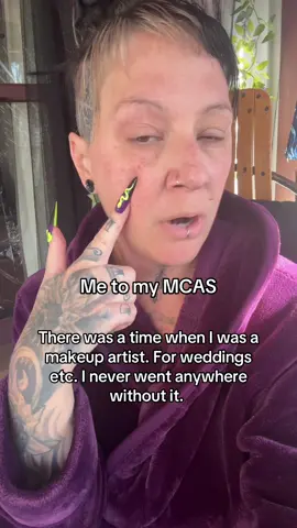 I cannot put anything on my body but jojoba & coconut oil. Better than nothing. 😂