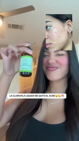Este suplemento te limpia por dentro, lo recomiendo muchísimo‼️‼️‼️ #acne #acnetreatment #cutis #clorofilaliquida #tiktokshopcybermonday  