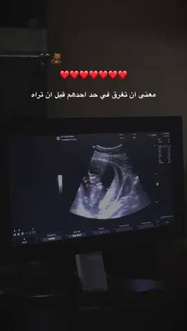 #bebe #Love #❤️❤️ 