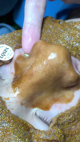 Mềm #chamsocdaseo#chamsocda#chamsocdamun#chamsocdanam#tanbinh        