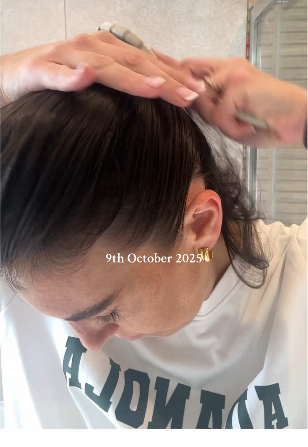 Speechless 😶 head to my showcase for what i’ve been using ❤️ #hairthinning #hairtransformation #thinhair #transformation #hairjourney 