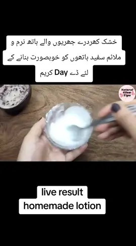 Winter lotion for dry skin | Moisturizer for oily skin | Hand and feet whitening formula cream ‪@almujarab.com In this video, I’ll show you how to make an amazing homemade winter lotion that deeply moisturizes dry skin, keeps oily skin fresh and non-greasy, and helps whiten and soften your hands and feet naturally. 🌸 This easy DIY lotion is perfect for winter when your skin becomes rough and dull. Regular use will make your skin soft, glowing, and bright. 💧 Benefits: ✅ Moisturizes dry and rough skin ✅ Controls excess oil for oily skin ✅ Whitens hands and feet naturally ✅ Makes skin soft, smooth, and glowing ✅ Wrinkles free hands 🌿 Best Time to Use: Use this lotion twice a day — in the morning and before sleeping at night for best results. If you like this video, don’t forget to 👍 Like, 💬 Comment, and 🔔 Subscribe for more natural beauty remedies! I hope this videos is helpful for you 😀 #naturalglowtips​  #whiteningcream​  #moisturizer​  #skinlightening​  #winterspecial​  ​