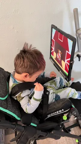 EyeGaze tracks a person’s eye movements to control a computer, tablet, or communication device allowing them to select words, pictures, or commands just by looking. #eyegaze #cerebralpalsy #quadriplegic #nonverbal #hie 