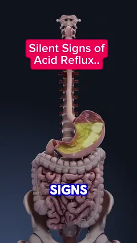 5 DANGEROUS SIGNS OF ACID REFLUX.. #acidreflux #acid 