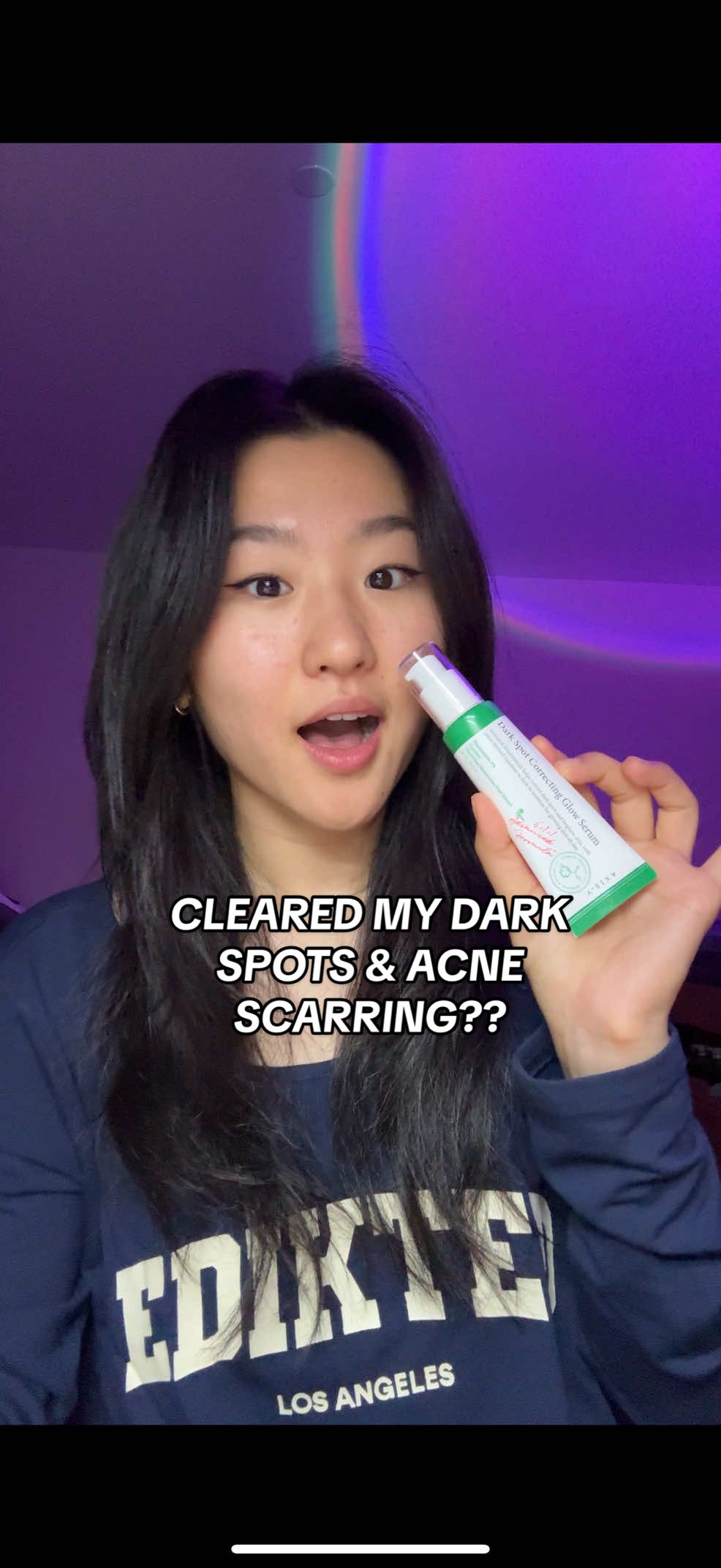 my skin?? SPOTLESS ✨🧼🫧 @AXIS-Y  #acne #kbeauty #darkspots #axisy #axisydarkspotserum 