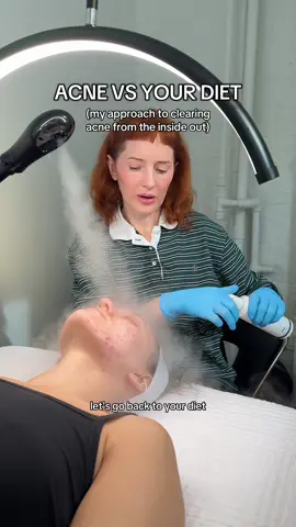 We take a 360 approach when treating our clients! #skincaretips #acnetips #acneskincare #acneproneskin #fiber 