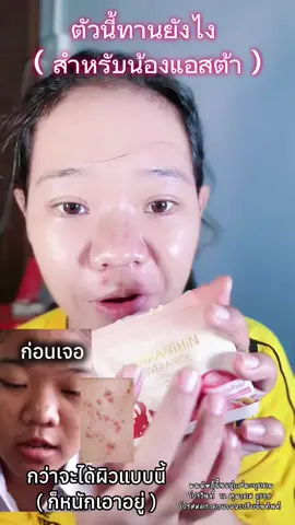#กลอรี่คอลลาเจนแม็กซ์โดส #กลอรี่คอลลาเจน1MaxDoseเท่ากับ1Drip #กลอรี่คอลลาเจนเกรดพี่รีเมี่ยมเข้มข้น30เท่า #Glorycollagen 