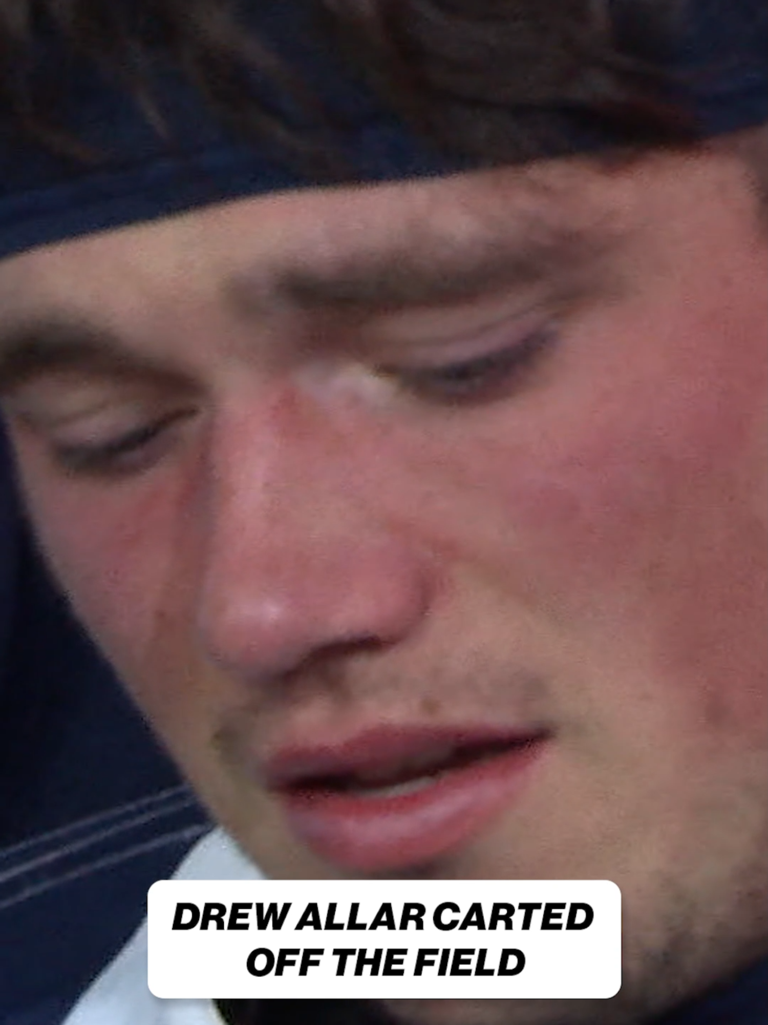 Drew Allar was carted into the locker room after this tackle.