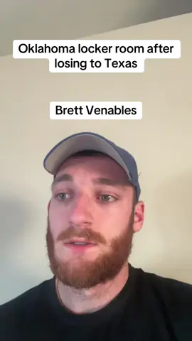 Dudes thumb is COOKED😔