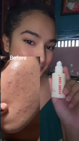 #KSECRETGlowChallenge #KSECRET #seoul1988 #glassskin #koreanskincare@KSECRET GLOBAL 