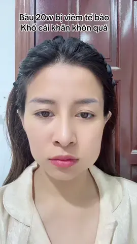Ai có ý định có bầu lo xử đẹp mấy nhỏ răng khôn đi nha. Trời ơi ta nói 3 đêm không ngủ được nó đau thấu trời xanh .... #mebau