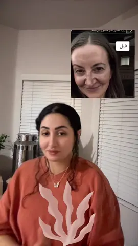 اشهر مكملات حاليا ينحجي عنها هي sea moss  #بنات_العراق #العراق #نضارة_البشرة #شد_البشرة #السعودية 