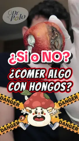 Aunque parezca que no hace daño, si puede contener microorganismo que si hacen daño!! (Compra solo lo que vas a comer e intenta no desperdiciar) más en YT #medicina #salud #polomed #AprendeEnTikTok  #cienciaentiktok 
