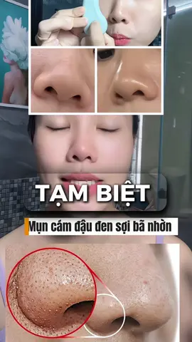 Dấu hiệu của việc tiêu xiền đúng cách là đây . Ngày xưa đi spa miết . Lần mấy trăm cành chỉ để lấy mụn cám mụn đầu đen . Giờ thì rinh ẻm dùng cả đời . Ko bao giờ mũi mất thẩm mỹ vì m đẩy mỗi ngày mờ 🥰#yêubảnthân #lamnaylamnochonggia #u40vẫnphaixinhđẹp #nặnmụn