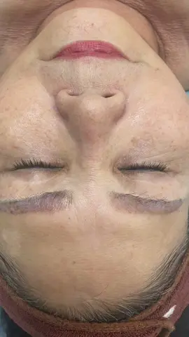 Thẩm mỹ Thơ Nguyễn t r ị n á m số 1 tại Trà Vinh