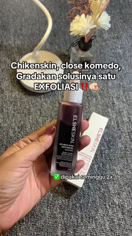 #elsheskin 