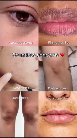 Countless concern’s one solution = Seoul 1988 : retinal liposome 4% + fermented beans 🫘  @KSECRET GLOBAL  #KSECRETGlowChallenge #KSECRET #seoul1988 #hyperpigmentation #darkspots 