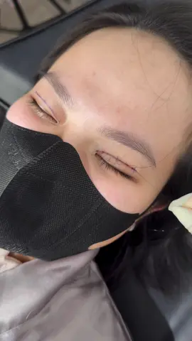 Kích mí đây ạ 🫶🏼 #nhấnmi #nhấnmíkhôngđau #nhấnmítựnhiên #thuduc #binhduong 