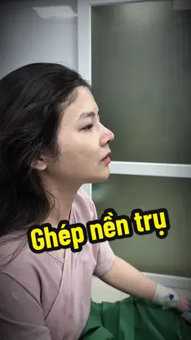 Ghép nền trụ mũi chống lõm nhân trung chỗ tiếp giáp chân trụ #nangmuisuntai #gheptrumui 