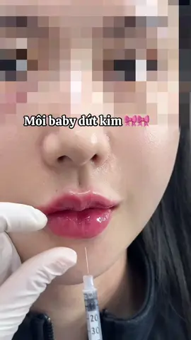 Các nàng thích baby hay tây #môixinh #tiêmmoi #xuhuongtiktok #nângtầngmặtgiữa #tiktokviral 