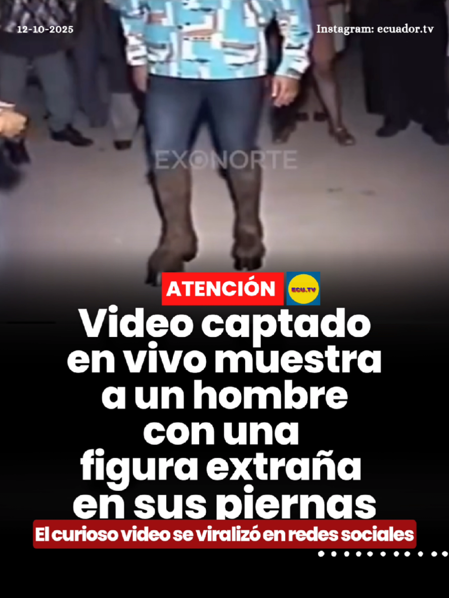 #ATENCIÓN | Video captado en vivo muestra a un hombre con una figura extraña en sus piernas 🚨. Un video grabado en vivo se ha viralizado recientemente en redes sociales tras mostrar un momento inquietante: un hombre aparece con una figura extraña sobre sus piernas, cuyo origen no ha sido explicado. El material ha generado todo tipo de reacciones, desde quienes creen que se trata de un fenómeno paranormal hasta quienes sugieren posibles explicaciones naturales.  Sin embargo, la escena ha despertado curiosidad y asombro entre los internautas, convirtiéndose en uno de los videos más comentados sobre actividad inexplicable en los últimos días.