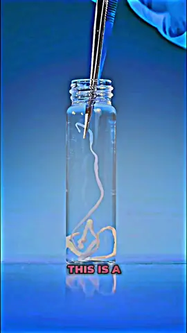 Worms from undercooked beef that attach to the human stomach and absorb nutrients #health #worms #paratiiiiiiiiiiiiiiiiiiiiiiiiiiiiiii #usa #biology 