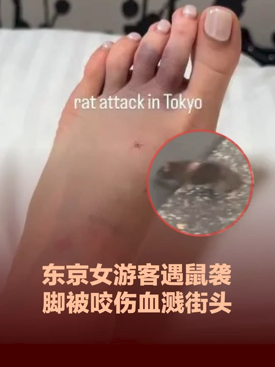 日本东京新宿发生女游客被老鼠咬伤事件，引发社会对鼠患与公共卫生的关注。  #日本 #东京 #老鼠 #鼠患 #卫生 #游客 #japan #tokyo #ratinfestation