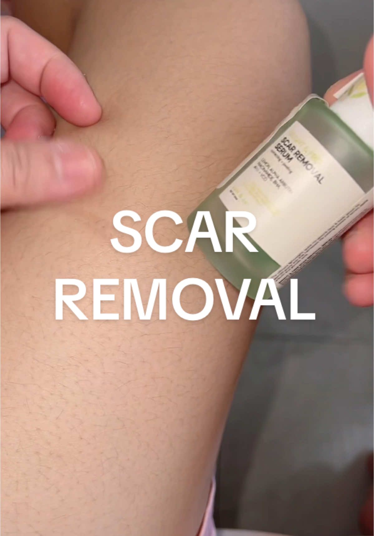 Peklat ko ng lighten sa scar removal serum