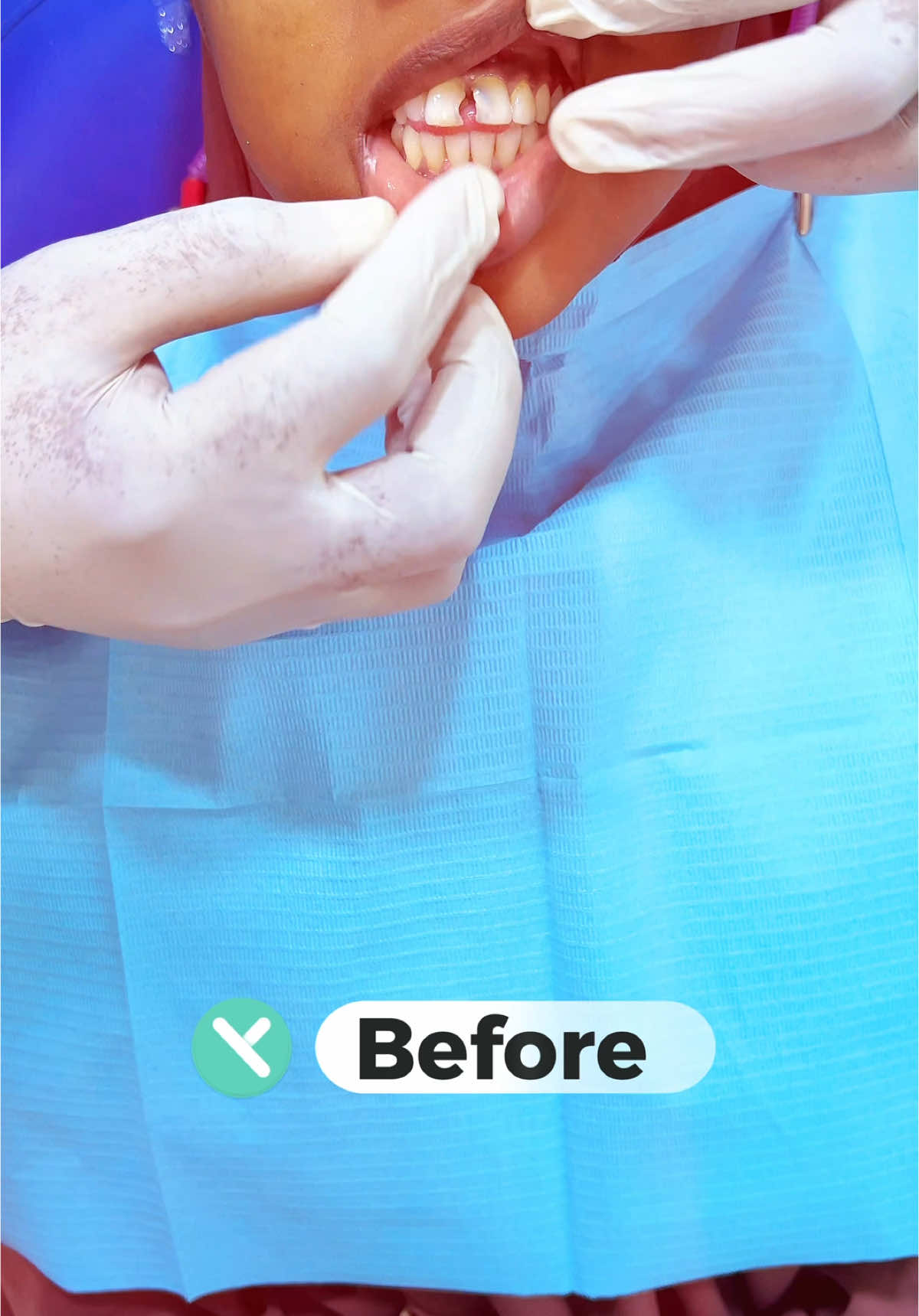 📍 Qiima dhimis ayaa Jirto Ka fa’ideysi wacan ❤️🩺 #dentist #ilkaha #somalidentist #muqdisho #viral #somalitiktok #kakaaftooncabashada🇸🇴🦷🇲🇾 