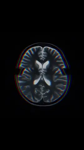 #alcohol #brainscience #darkpsychology 