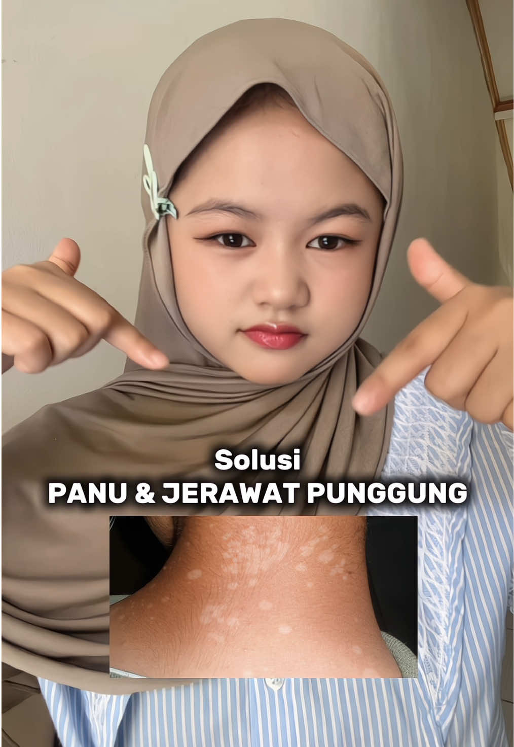 ini nih solusi yang praktis dari @By Jevarine Official #skinbodycastile #sabungatal #jevarine