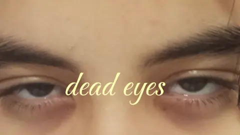 #güncel #deadeyes #tired #eyes #sadvibes🥀 