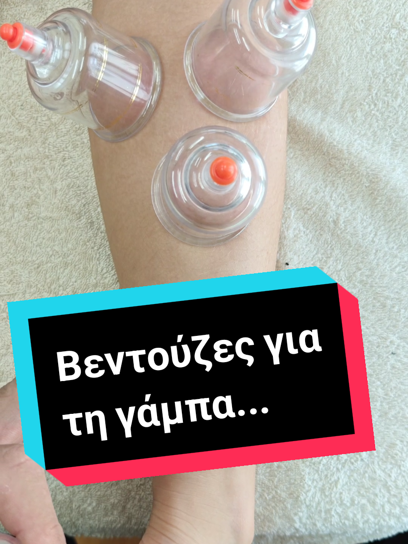 🎥 Εφαρμογή βεντούζας στη γάμπα Η βεντούζα είναι μια εξαιρετική τεχνική που βοηθά στη μείωση της μυϊκής έντασης, βελτίωση της κυκλοφορίας και επιτάχυνση της αποκατάστασης μετά από έντονη άσκηση ή καταπόνηση. Στο σημερινό βίντεο δείχνω πώς εφαρμόζεται σωστά στη γάμπα, ποια σημεία χρειάζονται προσοχή και ποια είναι τα βασικά οφέλη της. 💡 Πάντα με σεβασμό στους ιστούς και με τις κατάλληλες τεχνικές! #cuppingtherapy #βεντουζες #recovery #sportsmassage #χειροπρακτικη 