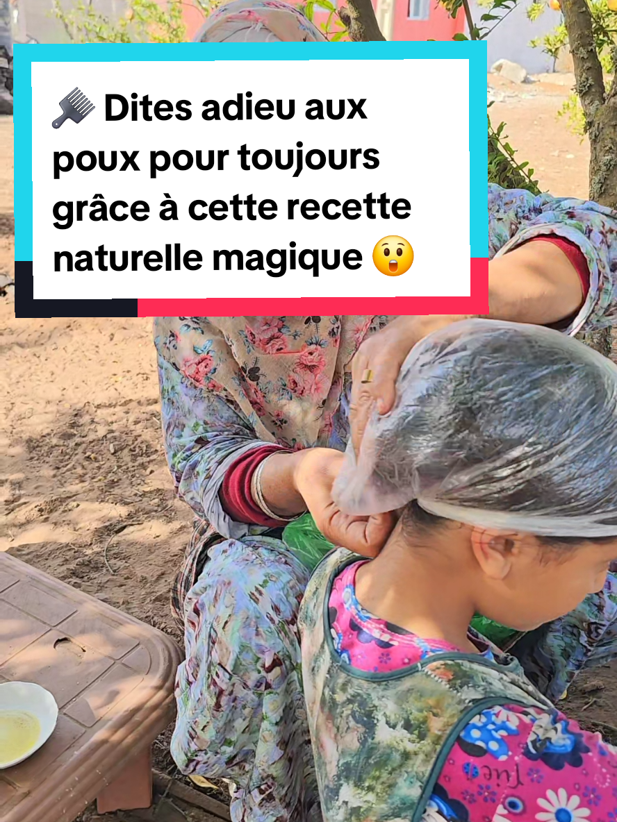 🪮 Say Goodbye to Lice Forever with This Magical Natural Remedy! 🇫🇷 Français: 🪮 Dites adieu aux poux pour toujours grâce à cette recette naturelle magique ! 🇮🇹 Italiano: 🪮 Dì addio ai pidocchi per sempre con questo rimedio naturale magico! 🇪🇸 Español: 🪮 ¡Despídete de los piojos para siempre con este remedio natural mágico! @مي مينة 🪬 @مي مينة 🪬 @🥀قناة مينة البدوية🥀 