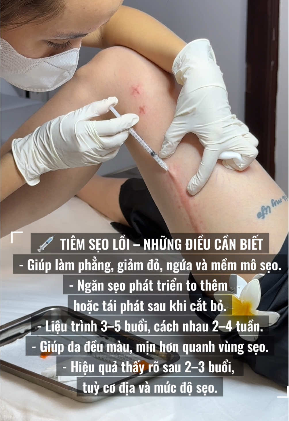 Tiêm sẹo lồi giá hssv 💵 chỉ từ 400 cành.  #tiemseoloi  #sẹolồi #trị_sẹo_lồi #xuhuong 