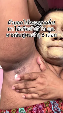 รุ้งี้ทาตั้งนานแล้ว #ครีมรักแร้คามู #รีวิวบิวตี้ #ใช้ดีบอกต่อ #ป้ายยาtiktok #มาร์คทองคําบอสหนุ่ม 