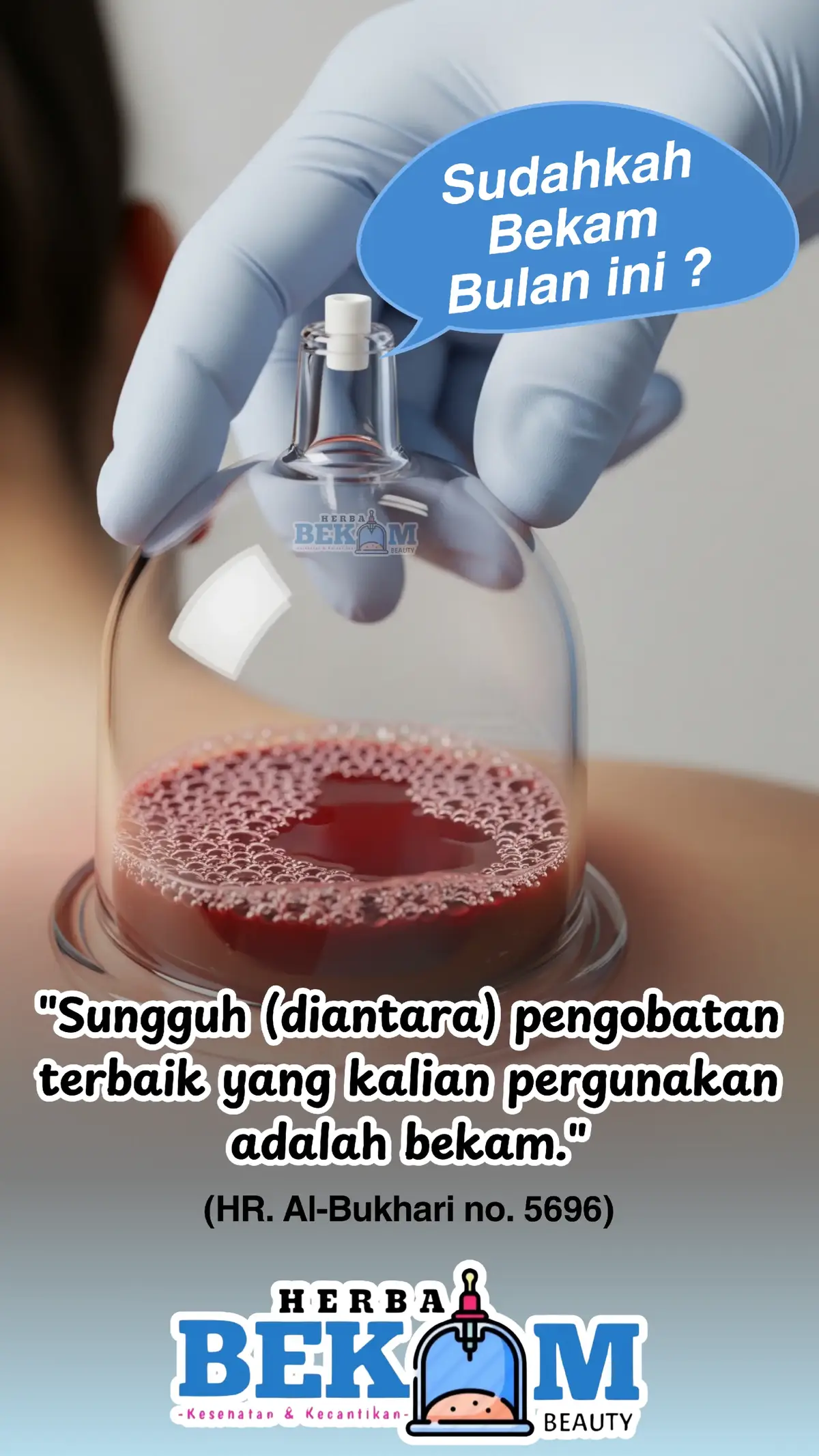 #bekam #hijama #cuppingtherapy #bekamdarah #sunnah 