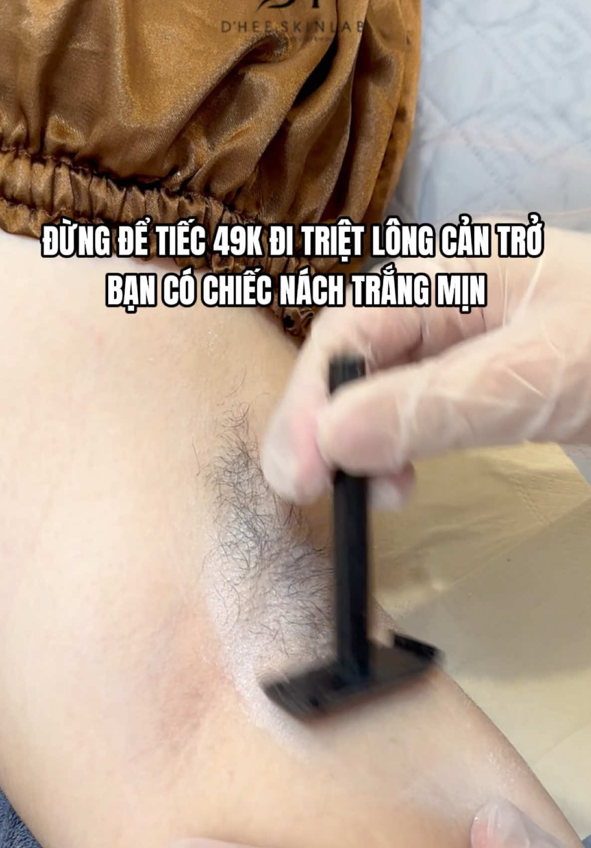 49 cành là triệt hết 2 nách luôn nha các nàng #trietlong #trietnach #reviewlamdep #spaphunhuan #trietnach49k 