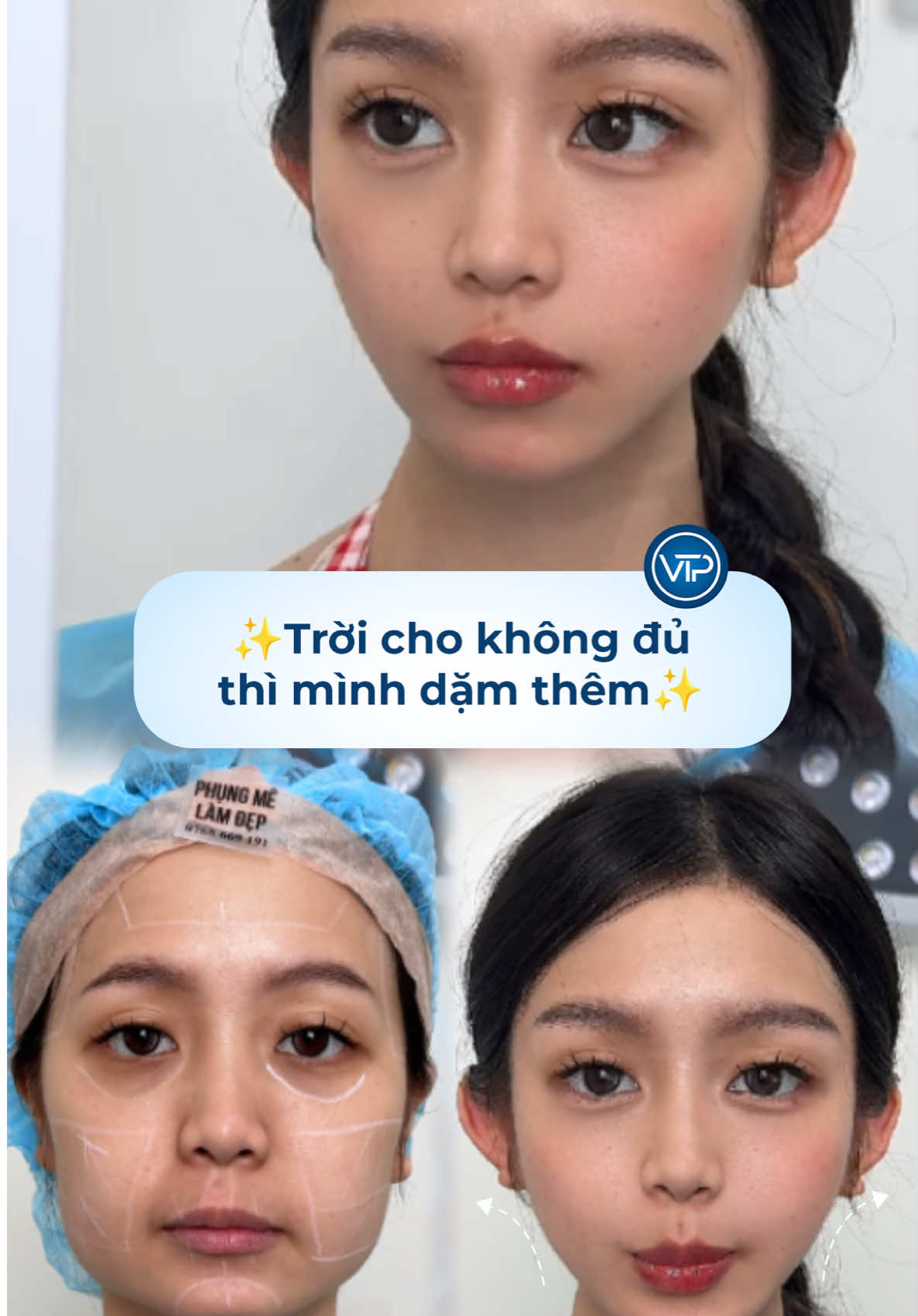 Trời cho không đủ thì mình dặm thêm 😘#phungmelamdep #vuthiphung #dinhcoamino #xuhuong 