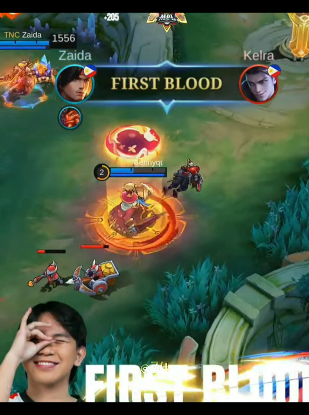 MAINET SI KELRA KAY BENNY🔥 #MLBB #MLBB9TH #fyppp #mlbbcreatorcamp #MLBBNEXT2025 