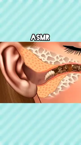 #ASMR #ASMRtreatment #RelaxingASMR #Satisfying #SatisfyingVideo 