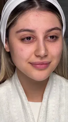 #beautytips #eyebrows #fyppppppppppppppppppppppp #unfreezemyacount #100kfollowers 